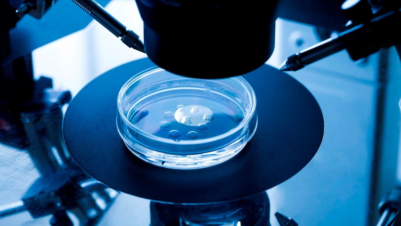 Tüp Bebek (IVF) Tedavisi